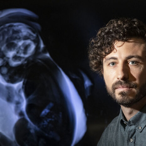Vlad Ayzenberg next to a baby scan