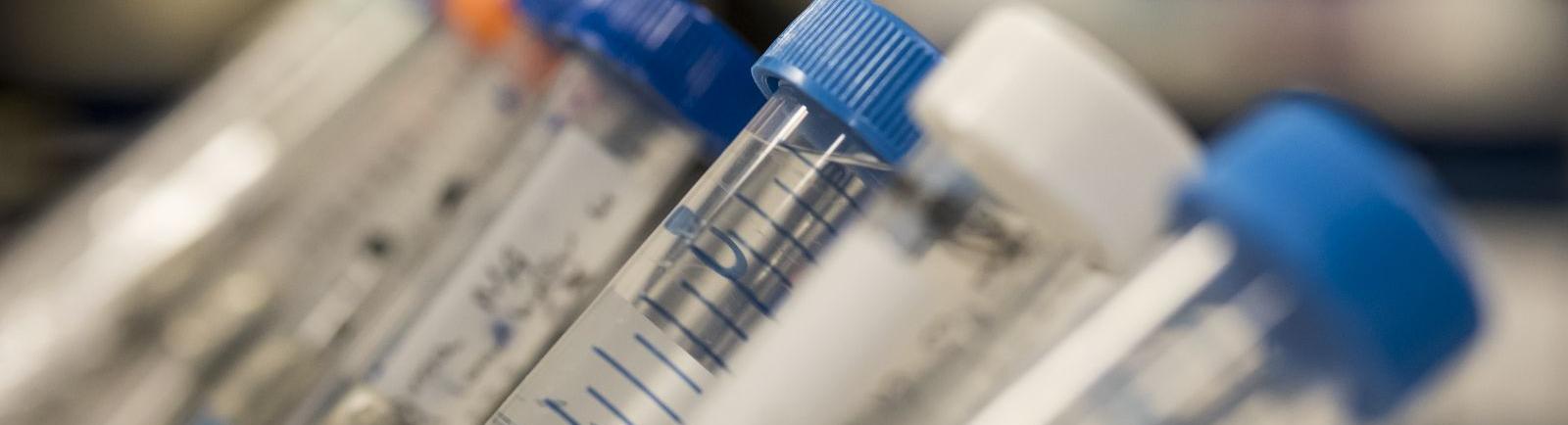 Test tubes in a biochemistry lab